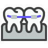 Braces